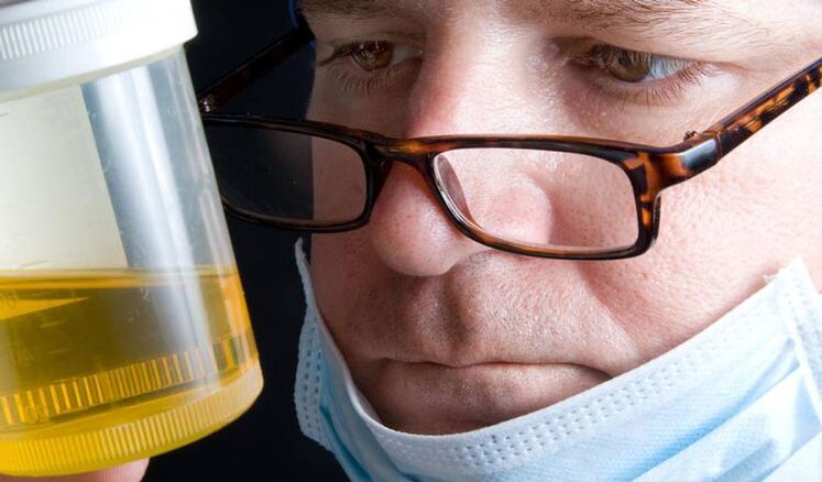 urine analysis for chronic prostatitis